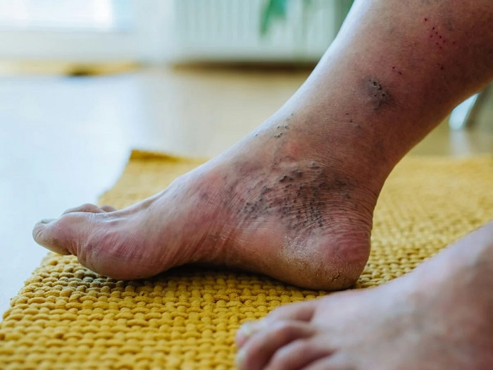 AVS PLASTIC SURGERY AND SKIN CLINIC Pudukkottai